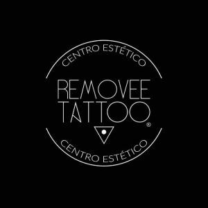 Removee Tattoo Centro Estético