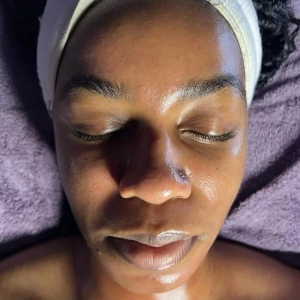 Limpeza de pele profunda