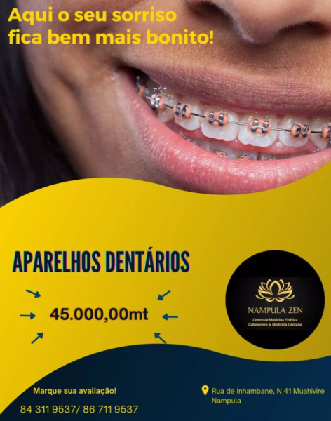 APARELHOS DENTARIOS