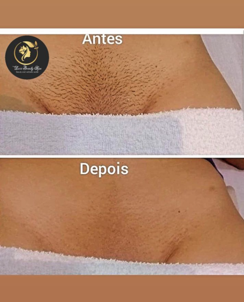 Depilação à cera 😻 Não mancha nem causa cortes. ...