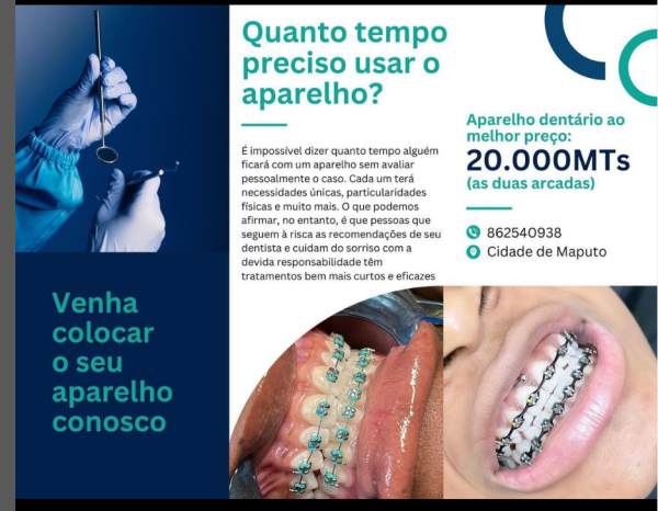 SERVIÇOS DE SAÚDE Aparelho dentário