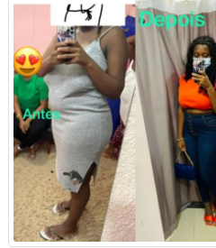 Primeira sessão de massagem modeladora