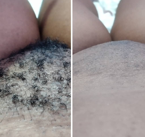 Por apenas 450 Mts fique Depiladíssima por até 2 meses.