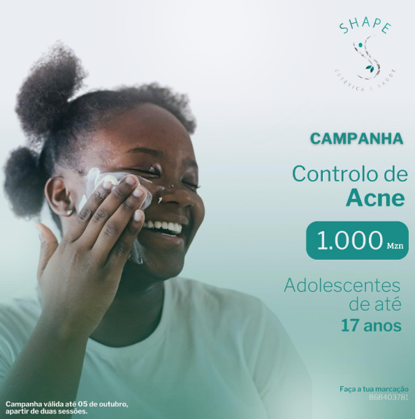 TRATAMENTO DE ACNE