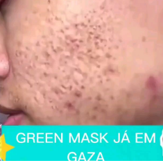 A Green Mask é uma máscara calmante, desenvolvida com ativos orgânicos, como camomila e aloe vera para atuar acalmando e regenerando a pele sensível e pele sensibilizada por excesso de sol ou procedimentos