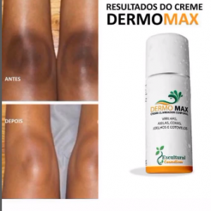 creme que auxilia no combate ao surgimento das estrias …