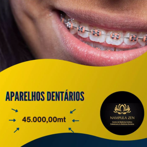 APARELHOS DENTARIOS
