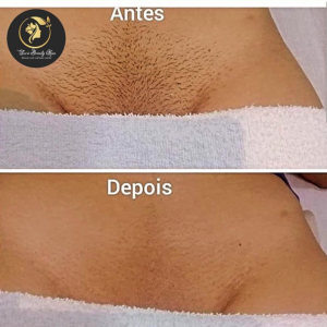 Depilação à cera 😻 Não mancha nem causa cortes. ...