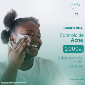 TRATAMENTO DE ACNE